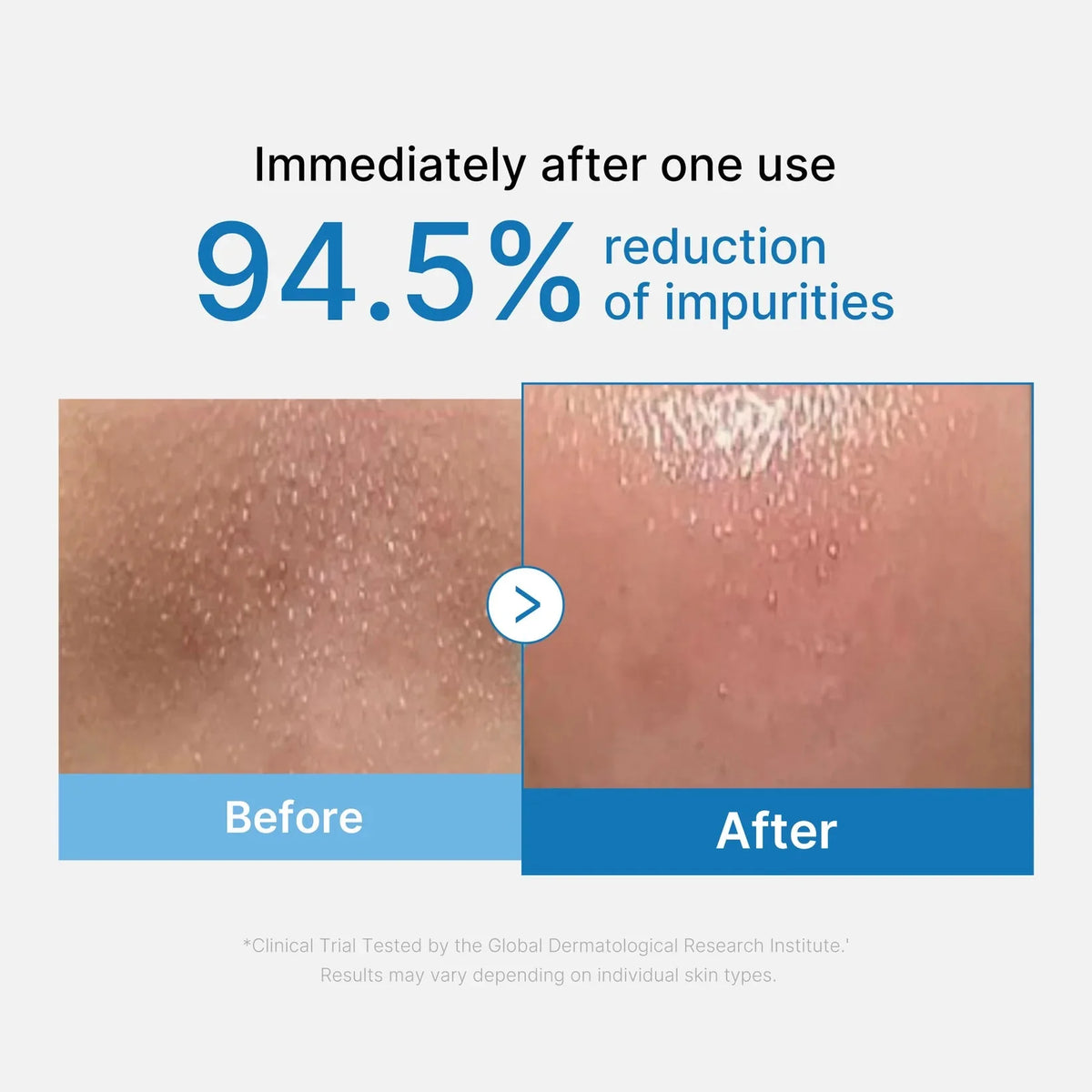 Medicube Pore Blackhead Deep Cleansing Oil medicube