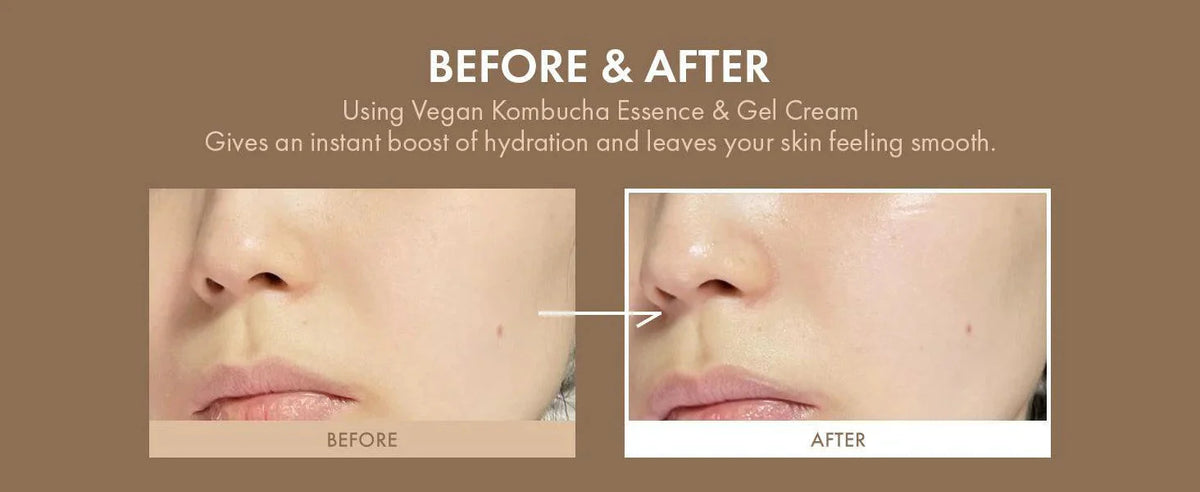 Dr.Ceuracle VEGAN KOMBUCHA TEA ESSENCE Dr.Ceuracle