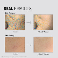 VT COSMETICS TX-TONING ESSENCE 2000 SHOT VT COSMETICS