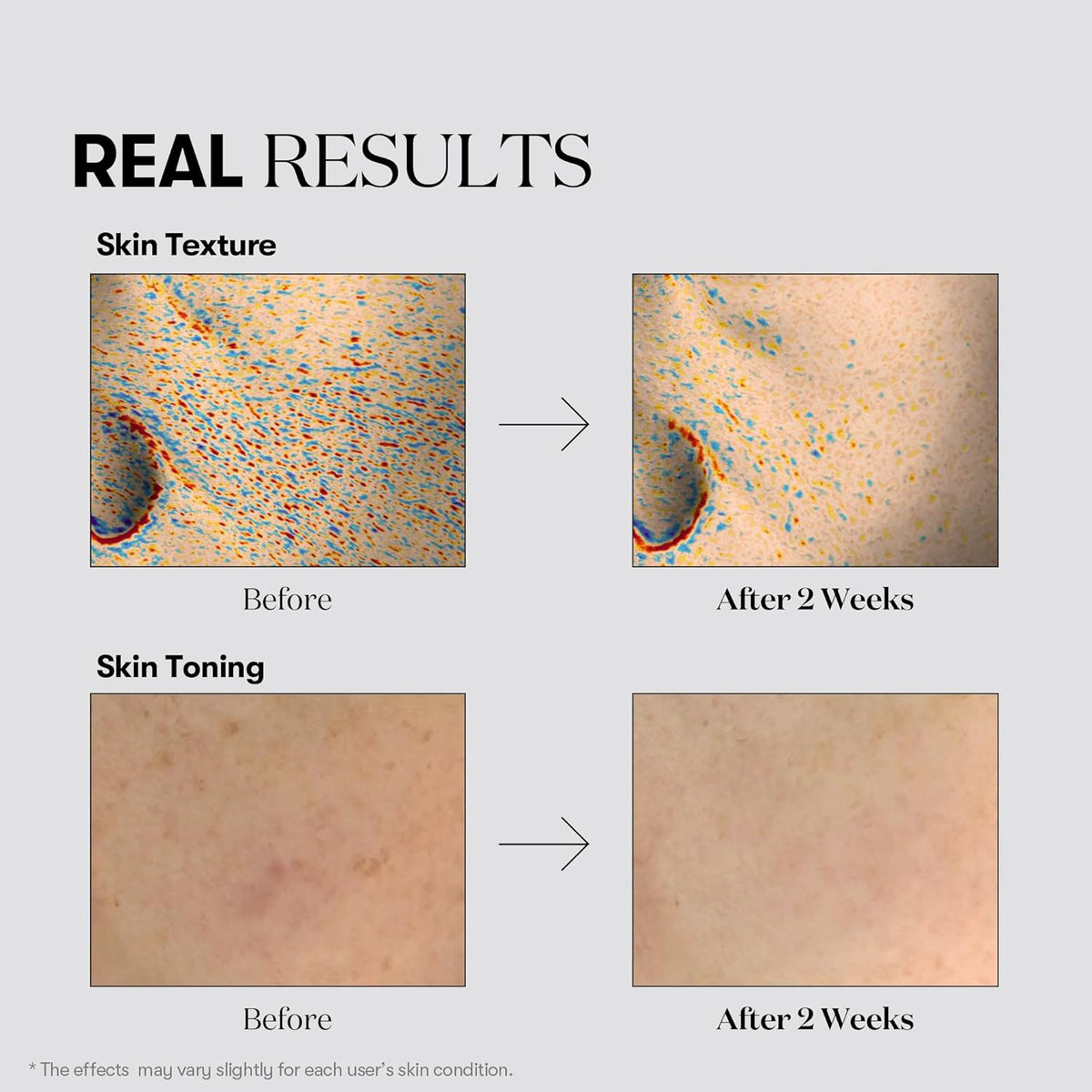 VT COSMETICS TX-TONING DAILY MASK VT COSMETICS