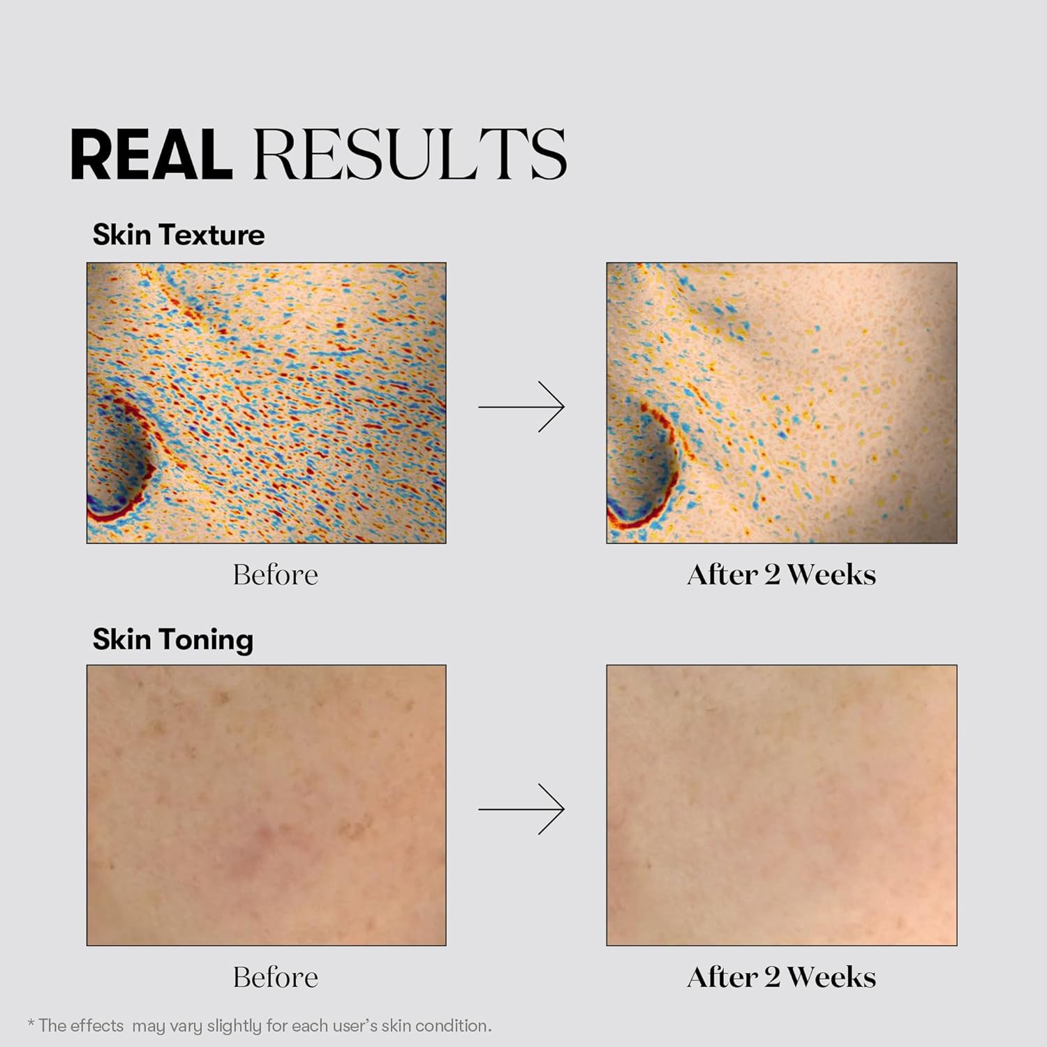 VT COSMETICS TX-TONING DAILY MASK VT COSMETICS