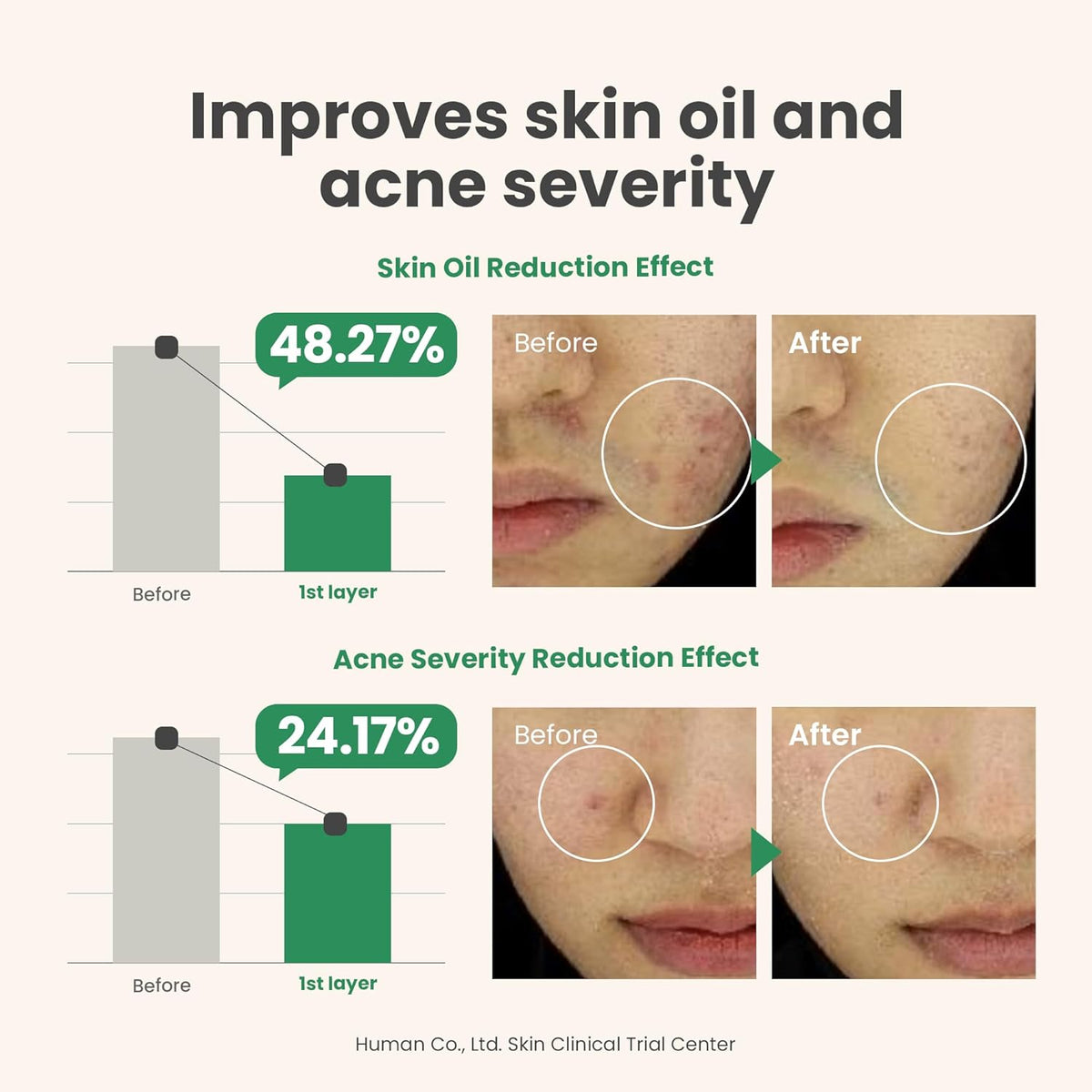 AXIS-Y Spot the Difference Blemish Treatment AXIS-Y