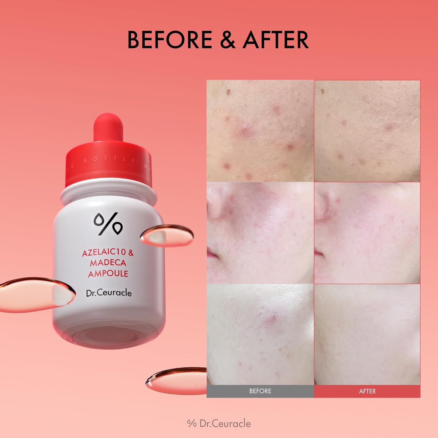 Dr.Ceuracle AZELAIC 10 & MADECA AMPOULE Dr.Ceuracle