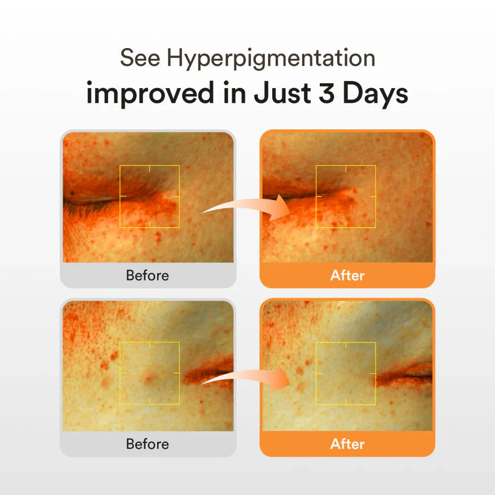 Abib Glutathiosome Dark Spot Serum Vita Drop Abib