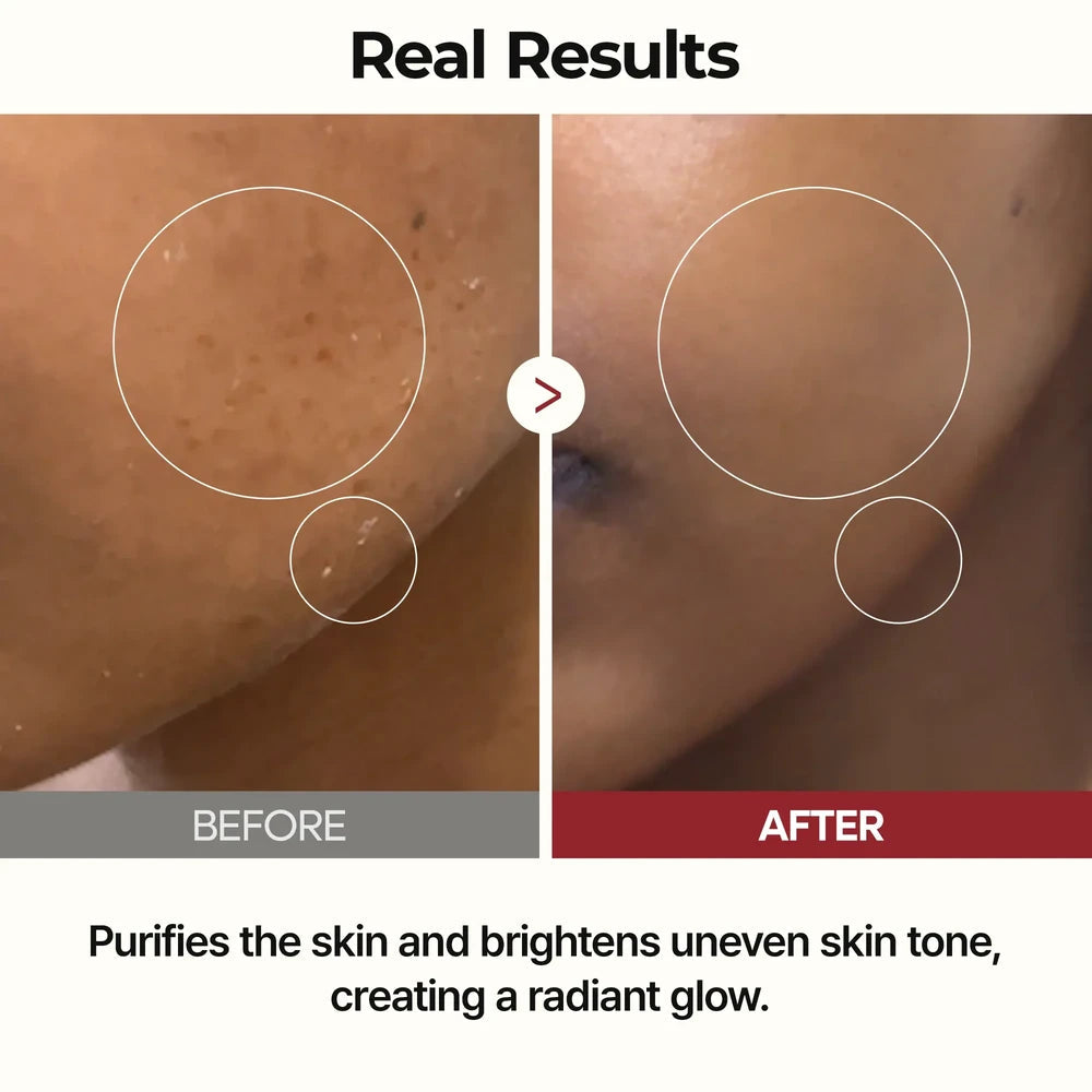 Dr.Melaxin PEEL SHOT GLOW WHITE RICE TONER