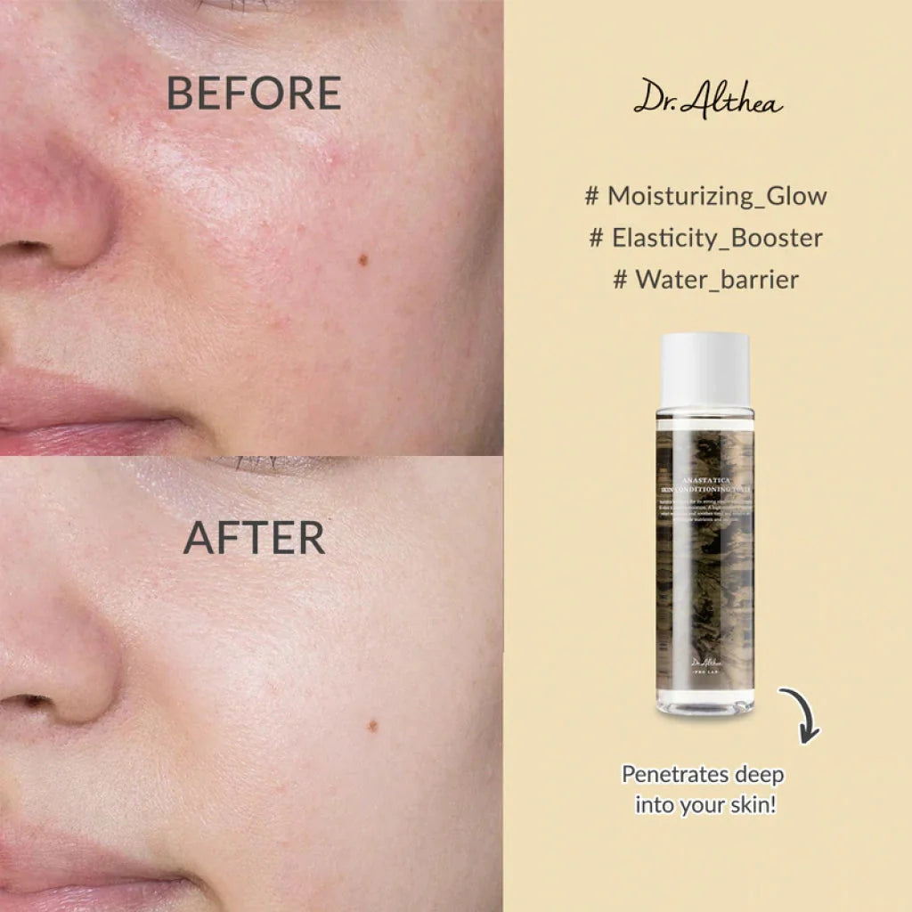 Dr.Althea Anastatica Skin Conditioning Toner Dr.Althea