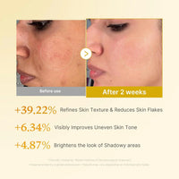 medicube Kojic Acid Turmeric Resurfacing Toner medicube