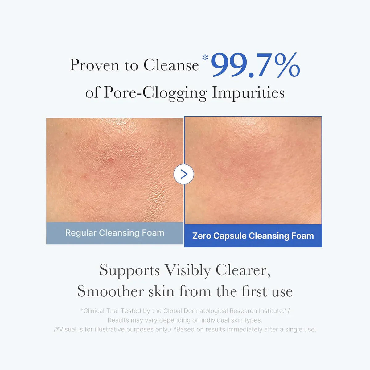 medicube Zero Pore Clearing Capsule Cleansing Foam medicube