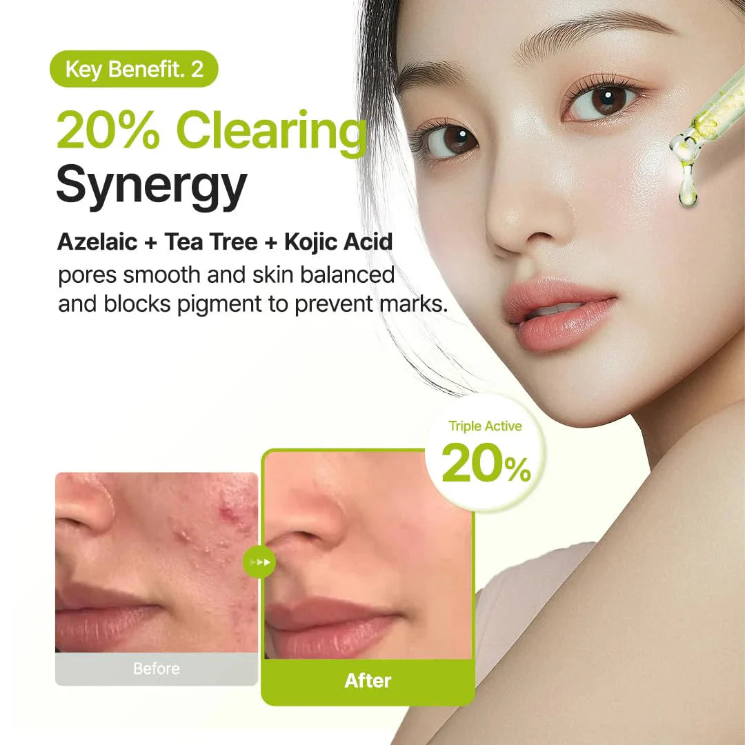PURITO SEOUL Azelaic Acid 10 Kojic Tea Tree Serum Purito Seoul