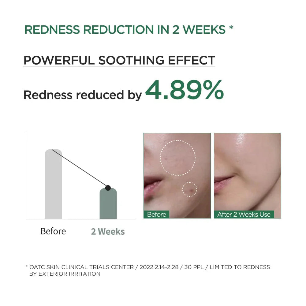 Anua Heartleaf 80% Moisture Soothing Ampoule Anua