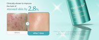 medicube Azelaic Acid Exosome Shot 2000 medicube