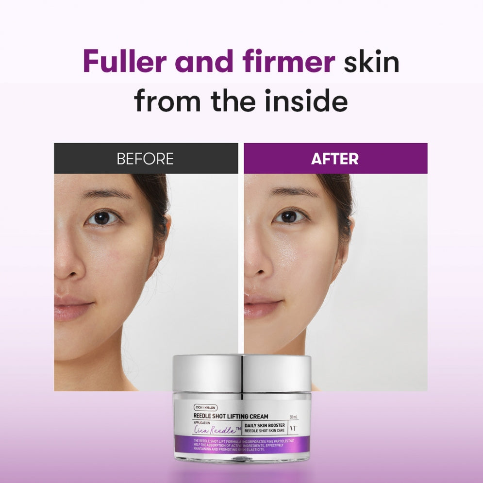 VT COSMETICS REEDLE SHOT LIFTING CREAM VT COSMETICS