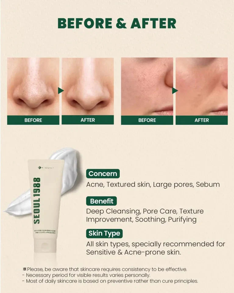 K-SECRET SEOUL 1988 Cleansing Foam: Pine Cica 1% + Probiotics K-SECRET